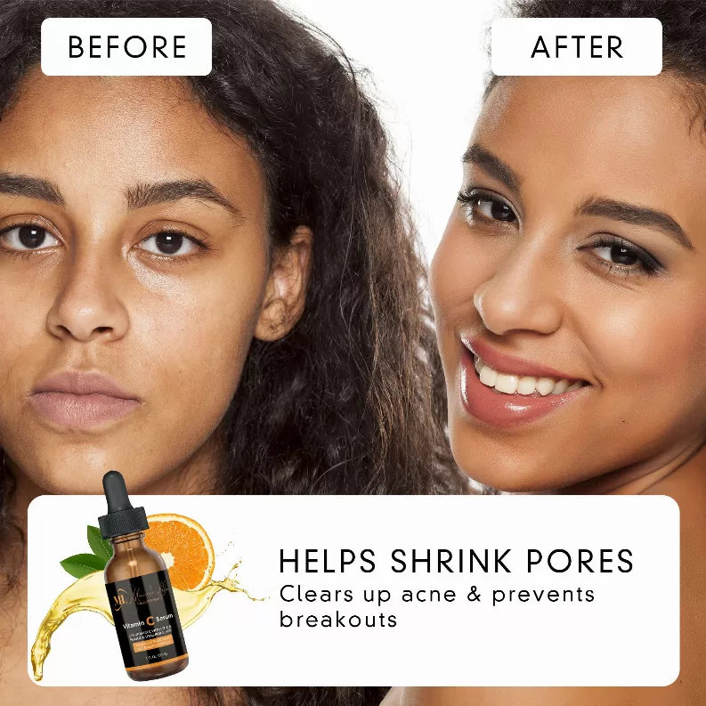 Advanced Anti-Aging Vitamin C Serum