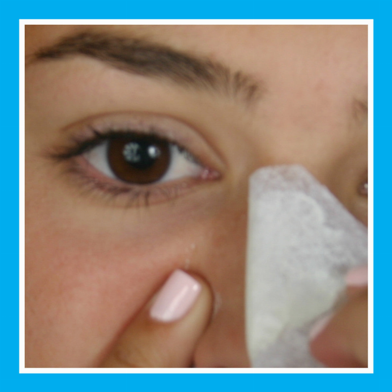 Blackhead Eliminator Kit