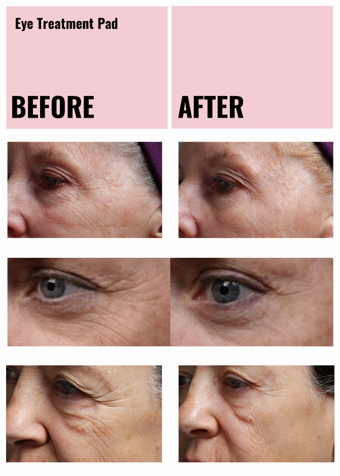 Ageless Beauty Skin Plumping Treatment Pads Wholesale Starter Kit