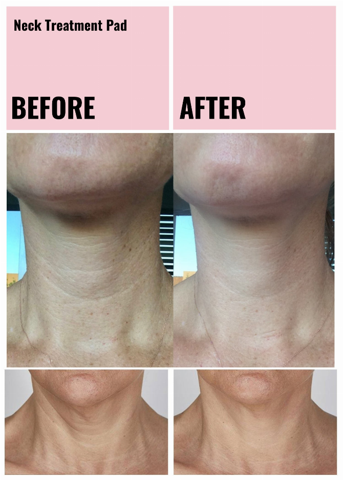 Ageless Beauty Skin Plumping Treatment Pads Wholesale Starter Kit