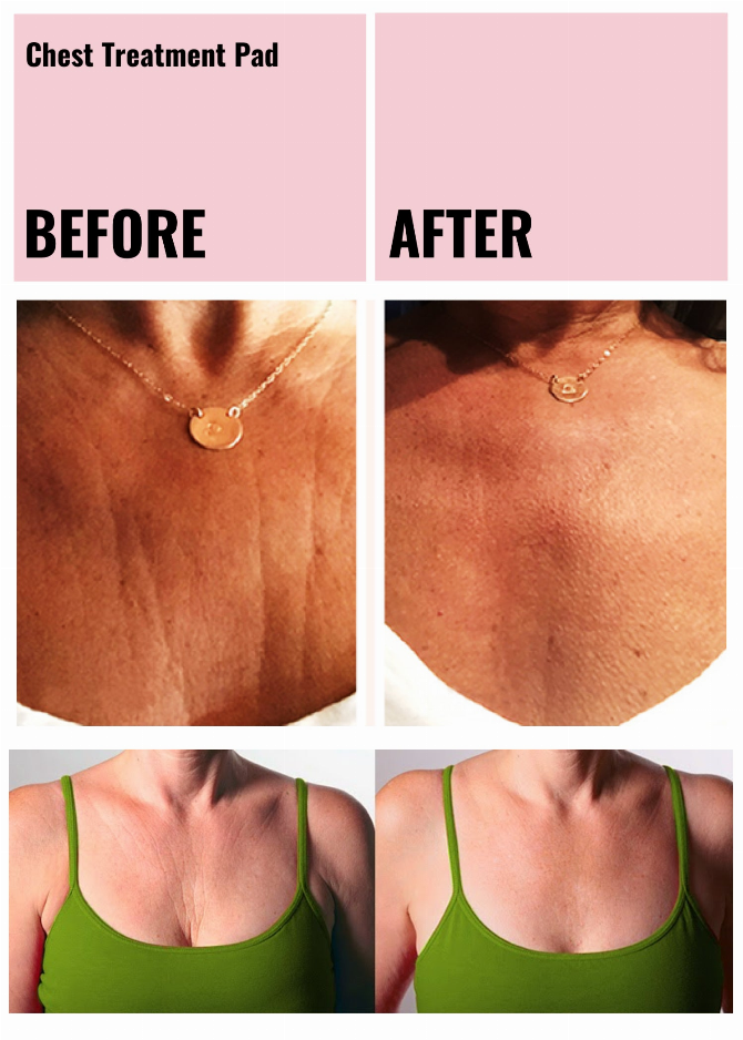 Ageless Beauty Skin Plumping Treatment Pads Wholesale Starter Kit