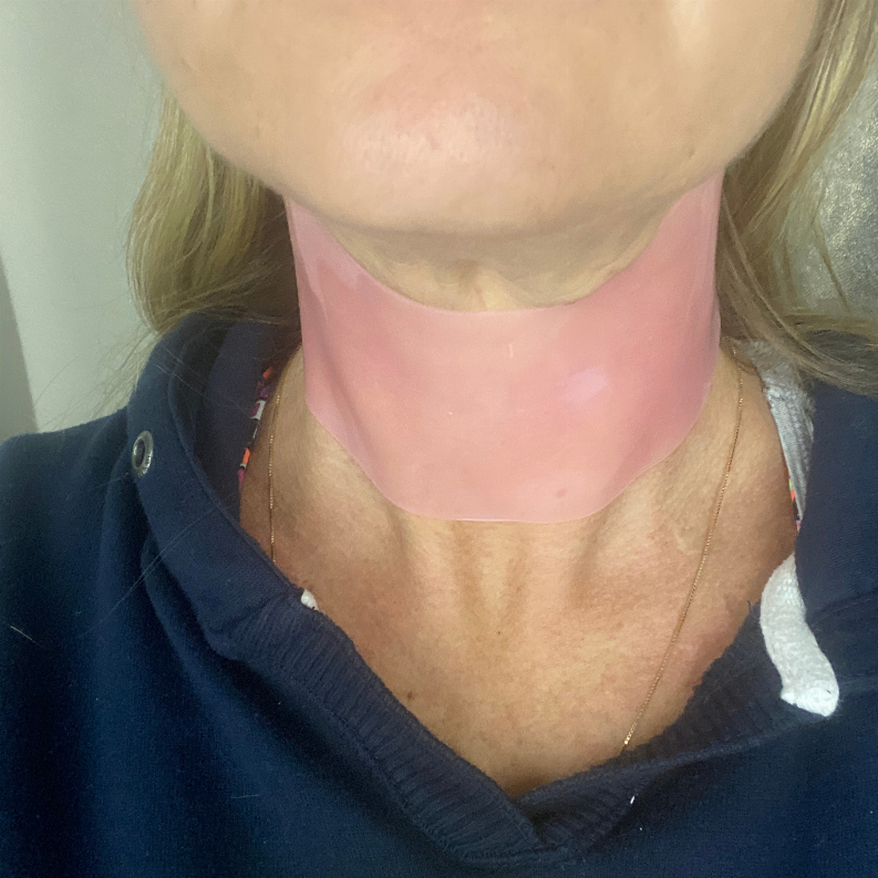 Hydra Reusable Neck Patch