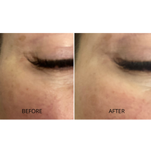 Hydra Reusable Eye Patches + Julie Lindh Skin Expert Hyaluronic Acid Rose Serum