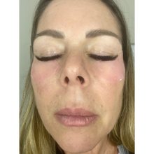 Hydra Reusable Eye Patches + Julie Lindh Skin Expert Hyaluronic Acid Rose Serum