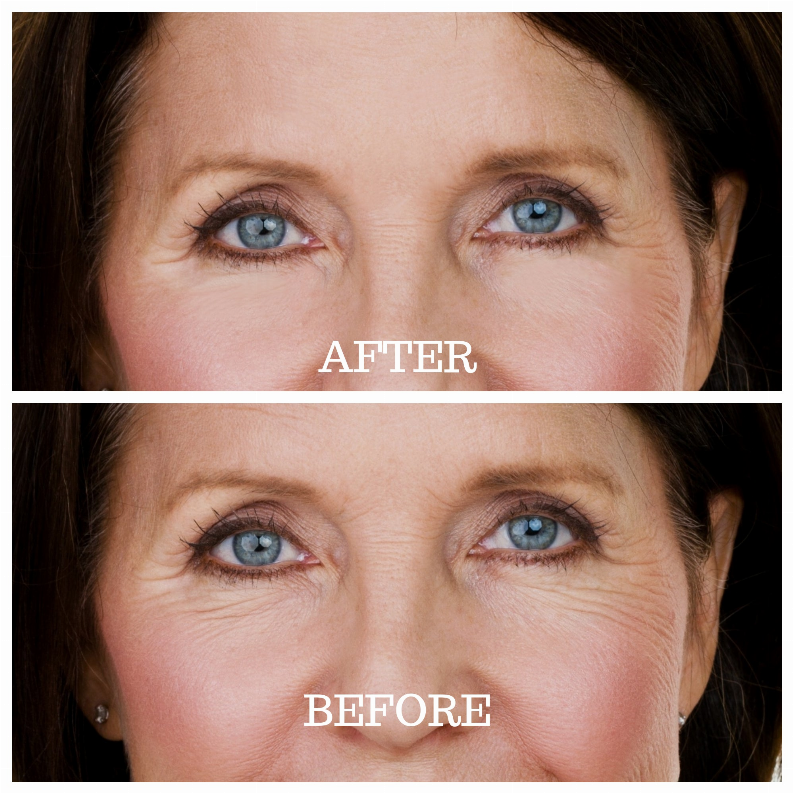 Skin Plumping Reusable Eye Treatment Pad