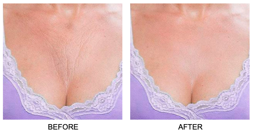 Skin Plumping Reusable Chest Treatment Pad
