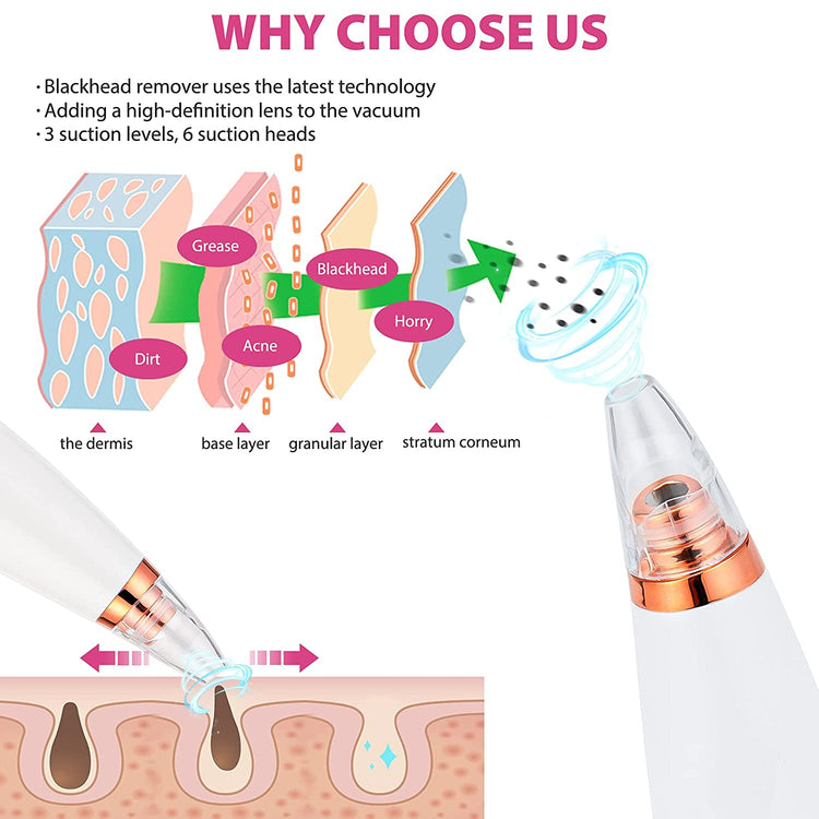Vacuum Blackhead Remover
